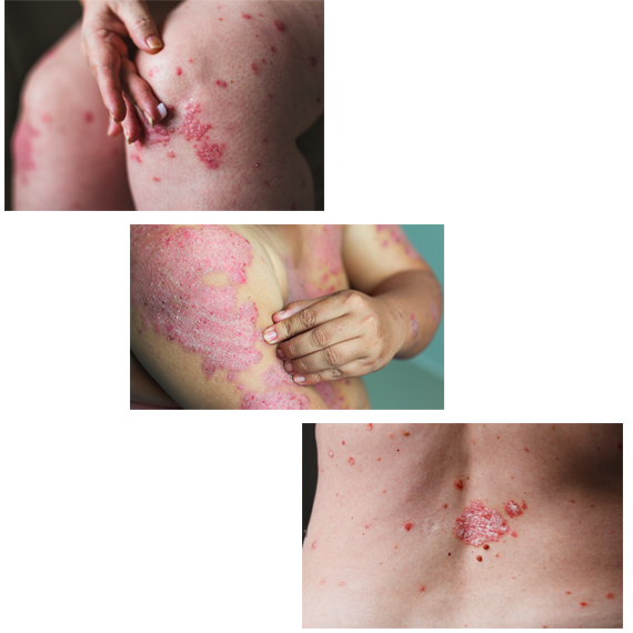 contact-skin-collage